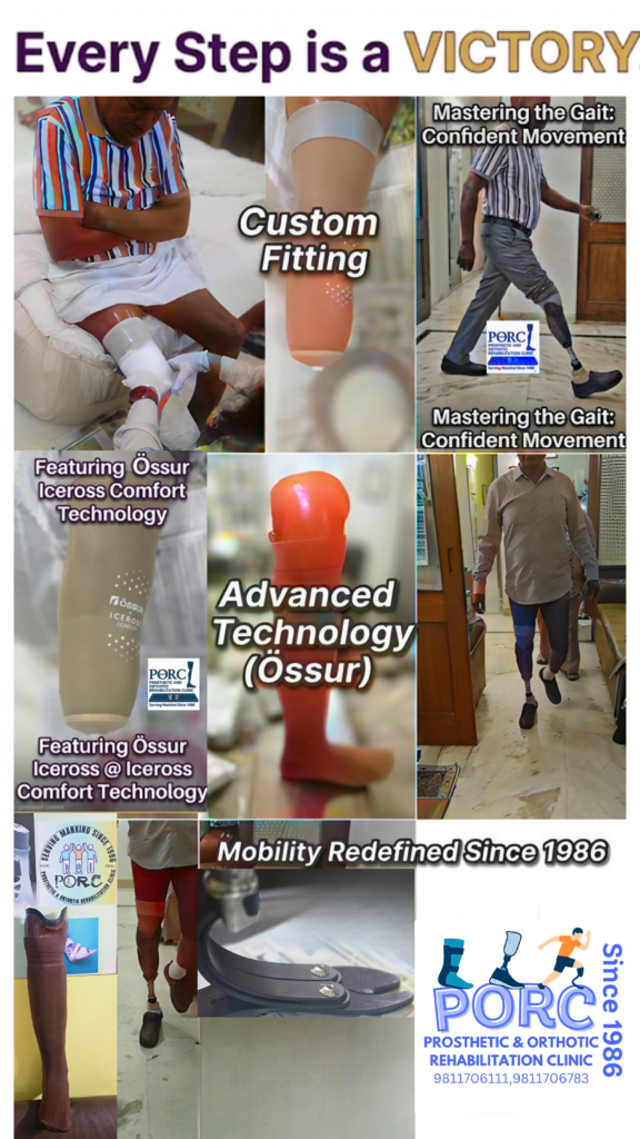 Orthotic braces and Ossur supports in Delhi NCR